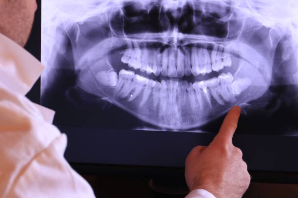 Best Emergency Root Canal Treatment in New Baltimore, MI