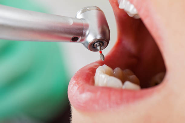 Best Emergency Treatment for Toothache in New Baltimore, MI